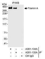 Filamin A Antibody in Immunoprecipitation (IP)