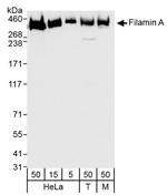 Filamin A Antibody in Western Blot (WB)