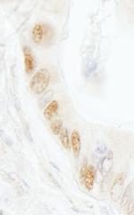 DNA Ligase 1 Antibody in Immunohistochemistry (Paraffin) (IHC (P))