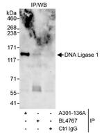 DNA Ligase 1 Antibody in Immunoprecipitation (IP)