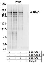 NCoR Antibody in Immunoprecipitation (IP)