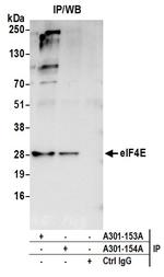 eIF4E Antibody in Immunoprecipitation (IP)