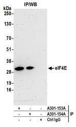 eIF4E Antibody in Immunoprecipitation (IP)