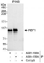 PIBF Antibody in Immunoprecipitation (IP)