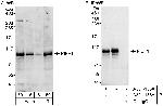 PIBF Antibody in Western Blot (WB)