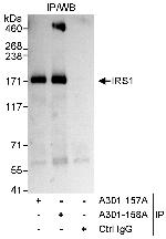 IRS1 Antibody in Immunoprecipitation (IP)