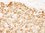 IRS1 Antibody in Immunohistochemistry (Paraffin) (IHC (P))