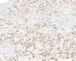 PML Antibody in Immunohistochemistry (Paraffin) (IHC (P))