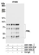 PML Antibody in Immunoprecipitation (IP)