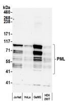 PML Antibody in Western Blot (WB)