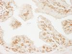 PML Antibody in Immunohistochemistry (Paraffin) (IHC (P))