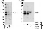 PML Antibody in Western Blot (WB)