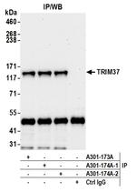 TRIM37 Antibody in Immunoprecipitation (IP)