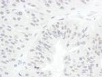 CDC20 Antibody in Immunohistochemistry (Paraffin) (IHC (P))