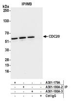 CDC20 Antibody in Immunoprecipitation (IP)