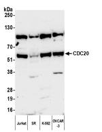 CDC20 Antibody in Western Blot (WB)