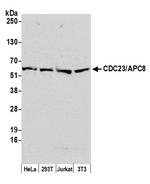 CDC23/APC8 Antibody in Western Blot (WB)