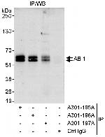 ABI1 Antibody in Immunoprecipitation (IP)