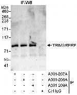 TRIM3/BERP Antibody in Immunoprecipitation (IP)