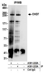 CHD7 Antibody in Immunoprecipitation (IP)