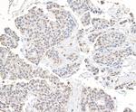 CHD8 Antibody in Immunohistochemistry (Paraffin) (IHC (P))