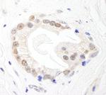 BRF1 Antibody in Immunohistochemistry (Paraffin) (IHC (P))