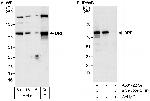 BRF1 Antibody in Western Blot (WB)