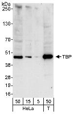 TBP Antibody in Western Blot (WB)