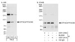 GTF3C4/TFIIIC90 Antibody in Western Blot (WB)