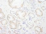 GTF3C4/TFIIIC90 Antibody in Immunohistochemistry (Paraffin) (IHC (P))