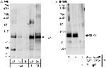 TLK1 Antibody in Western Blot (WB)