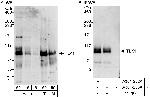 TLK1 Antibody in Western Blot (WB)