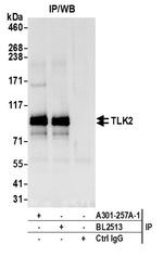 TLK2 Antibody in Immunoprecipitation (IP)