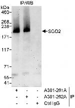 SGO2 Antibody in Immunoprecipitation (IP)