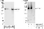 SGO2 Antibody in Western Blot (WB)