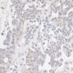 p16INK4a Antibody in Immunohistochemistry (Paraffin) (IHC (P))