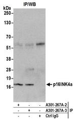 p16INK4a Antibody in Immunoprecipitation (IP)