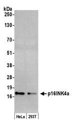 p16INK4a Antibody in Western Blot (WB)