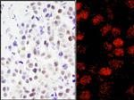 RCOR3 Antibody in Immunohistochemistry (Paraffin) (IHC (P))