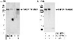 THRAP1/TRAP240 Antibody in Western Blot (WB)