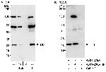 TK1 Antibody in Western Blot (WB)