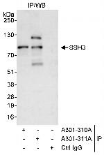 SSH3 Antibody in Immunoprecipitation (IP)