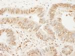 SSH3 Antibody in Immunohistochemistry (Paraffin) (IHC (P))