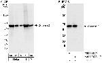 Coronin 2 Antibody in Western Blot (WB)