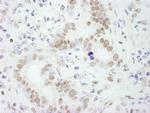 PSF/SFPQ Antibody in Immunohistochemistry (Paraffin) (IHC (P))