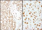 PSF/SFPQ Antibody in Immunohistochemistry (Paraffin) (IHC (P))