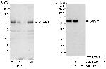 Gemin5 Antibody in Western Blot (WB)