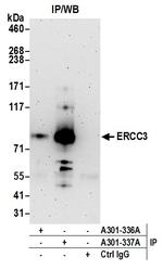 ERCC3 Antibody in Immunoprecipitation (IP)