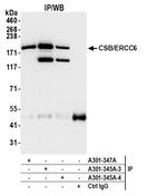 CSB/ERCC6 Antibody in Immunoprecipitation (IP)