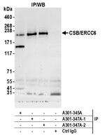 CSB/ERCC6 Antibody in Immunoprecipitation (IP)